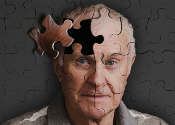 Alzheimer Hastalığı Nedir? Alzheimer Hastalığının Nedenleri ve Tedavisi Nelerdir? 10 Alzheimer Hastalığı Nedir Alzheimer Hastalığının Nedenleri ve Tedavisi Nelerdir