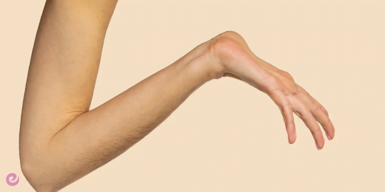 Marfan Sendromu Nedir? Marfan Sendromu Tedavisi 1 Marfan Sendromu Nedir Belirtileri, Nedenleri ve Tedavisi